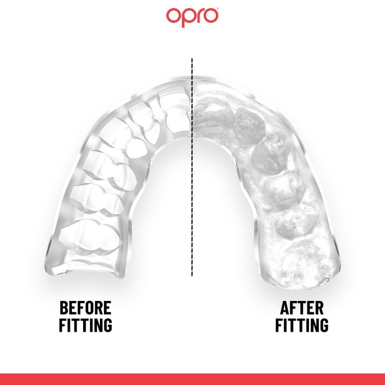 Opro Mouth Guard  France Instant Custom Fit